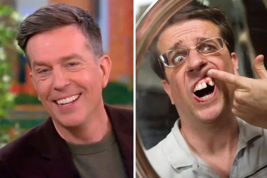 Ed Helms, best known for his role in The Hangover, has a unique dental story. Born with a congenital condition that left him with a missing tooth, Helms turned to dental implants for a permanent solution. Interestingly, during the filming of The Hangover, Helms temporarily removed his implant to authentically portray his character's missing tooth. His story showcases the versatility of implants in addressing congenital dental issues while accommodating professional demands.