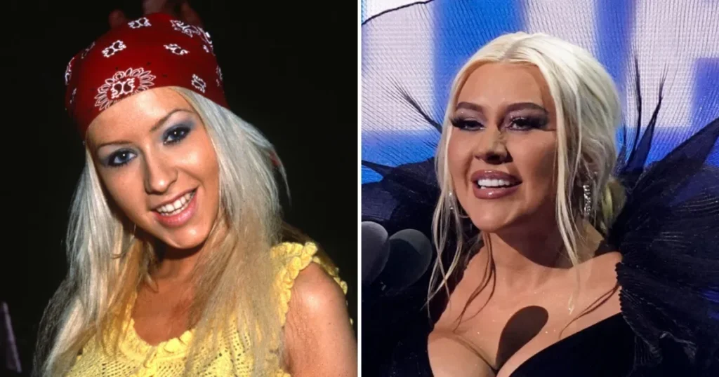 Christina Aguilera, the pop sensation, is often praised for her radiant smile. While Aguilera has not publicly discussed her dental work, dental professionals speculate that implants are part of her flawless look. Her smile enhances her stage presence, demonstrating how dental enhancements can amplify confidence and charisma.