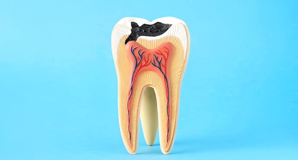 Cuanto cuesta una endodoncia