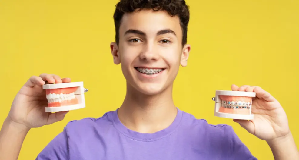 How much do braces cost?