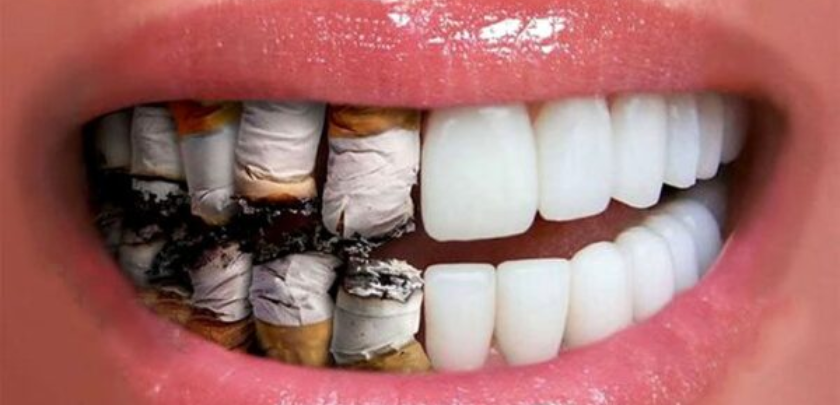 How Smoking Affects Your Dental Implants: Risks, Facts, and Prevention Tips