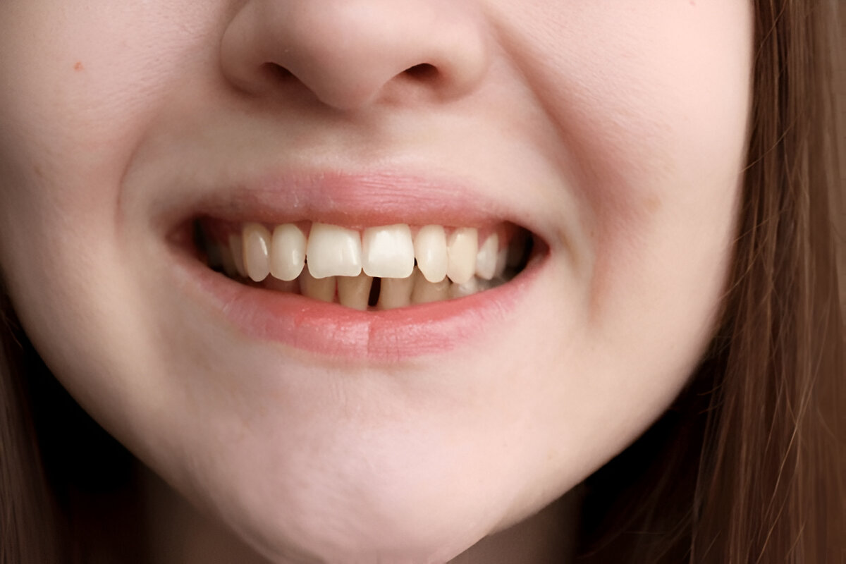 How Your Bite Affects Your Posture