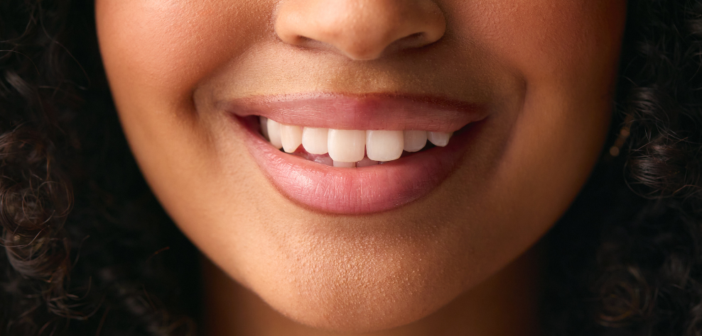 Odontoiatria estetica: il sorriso che meriti, senza compromessi