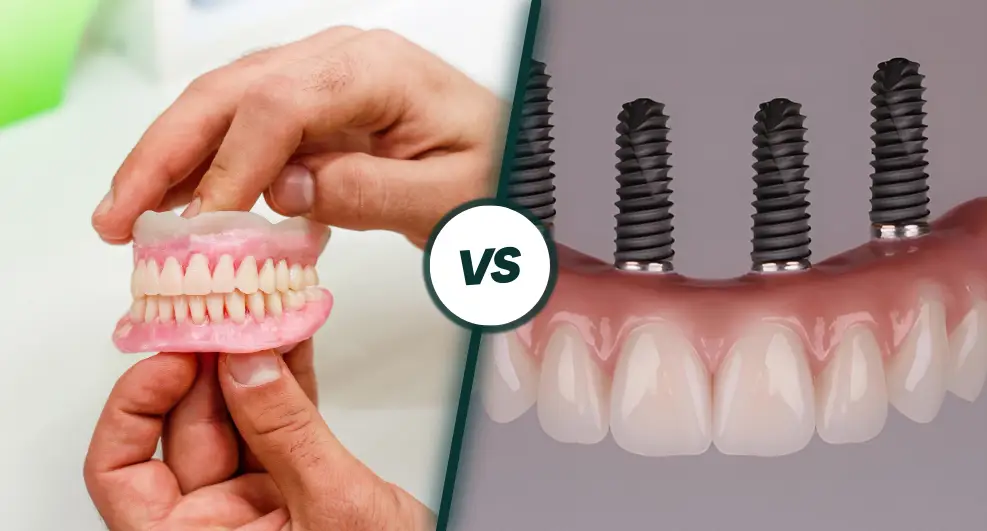 Poner dientes postizos