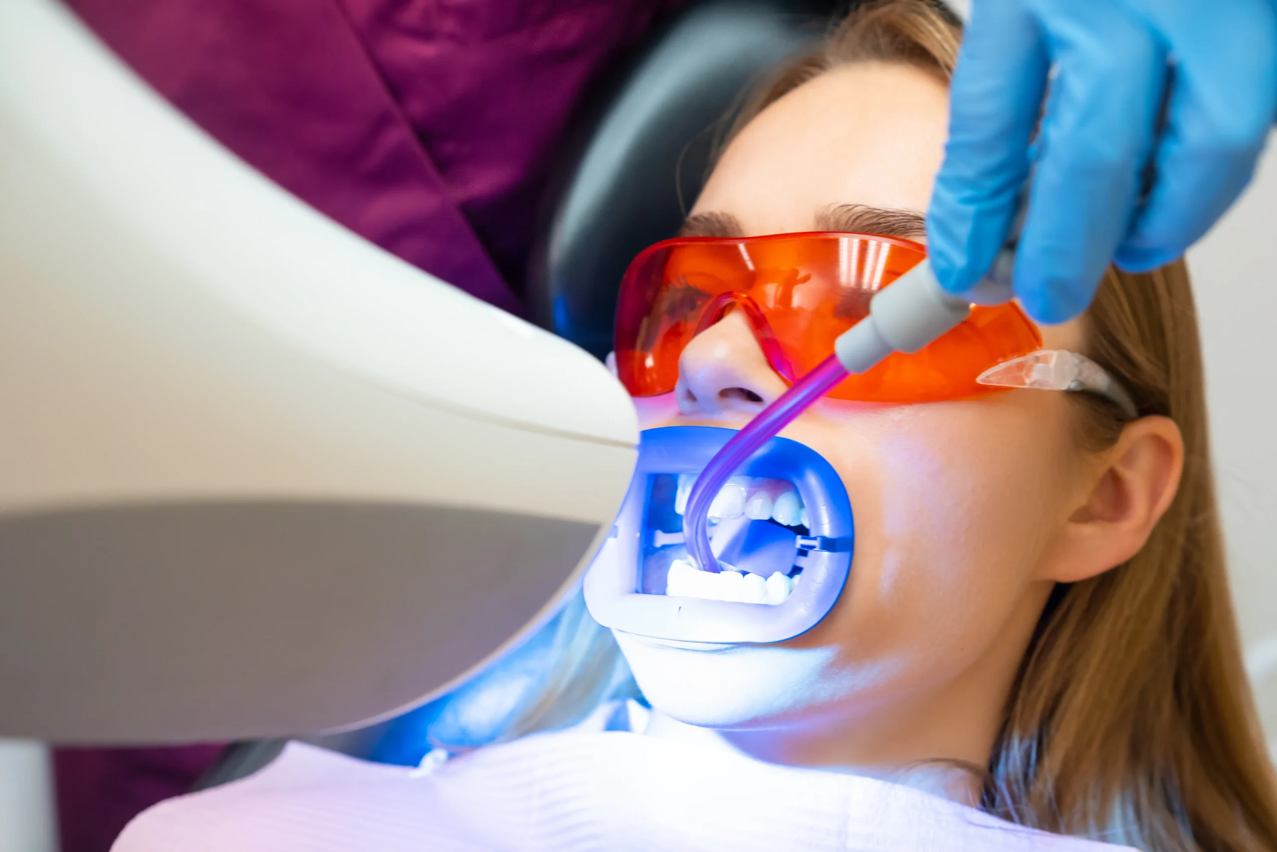 Pulizia e sbiancamento denti costo