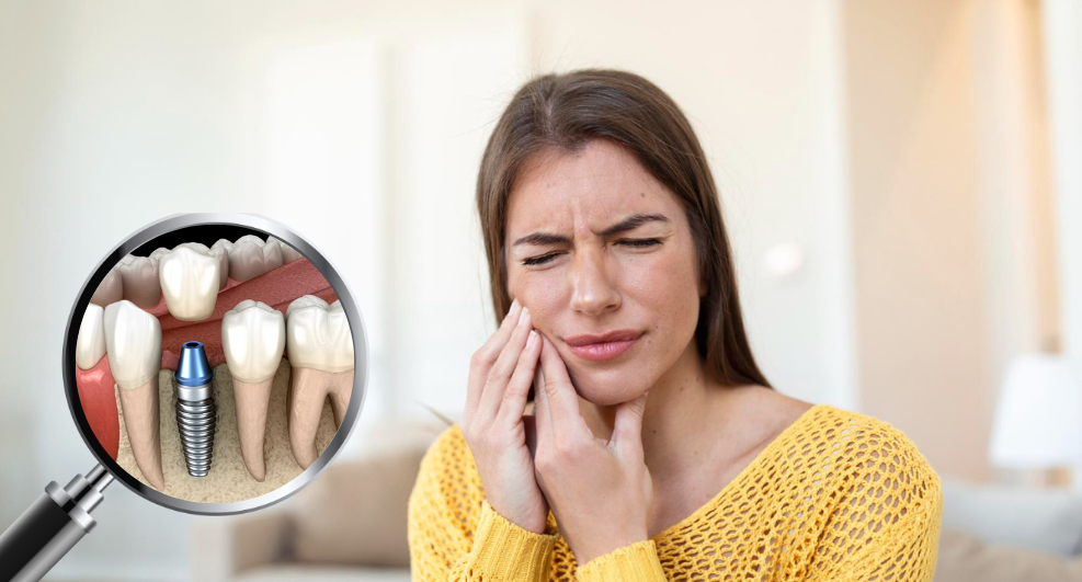 Si të kujdeseni për implantet dentare?