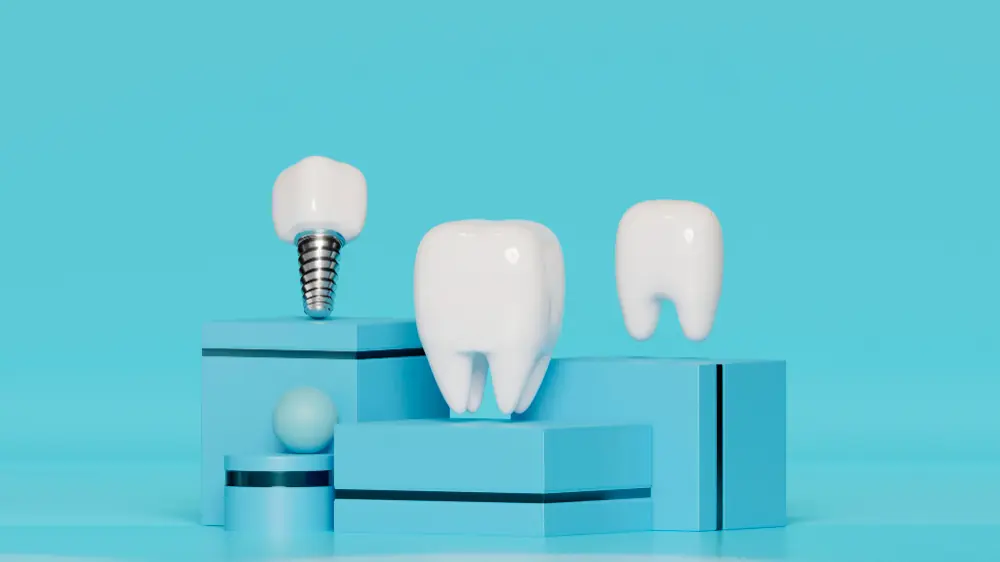 Top 10 Best Dental Implant Brands: Your Comprehensive Guide to Quality and Innovation