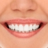 Teeth Whitening